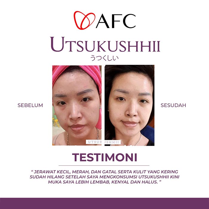 Testimoni Utsukushhii Jasa Landingpage 6 Testimoni Utsukushhii Jasa Landingpage 6