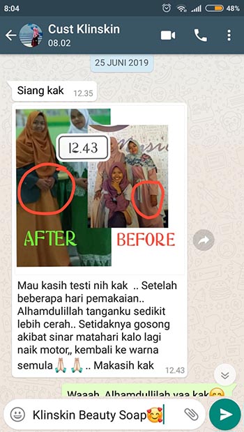 Testimoni KlinSkin Bodycare Jasa Landing Page 8